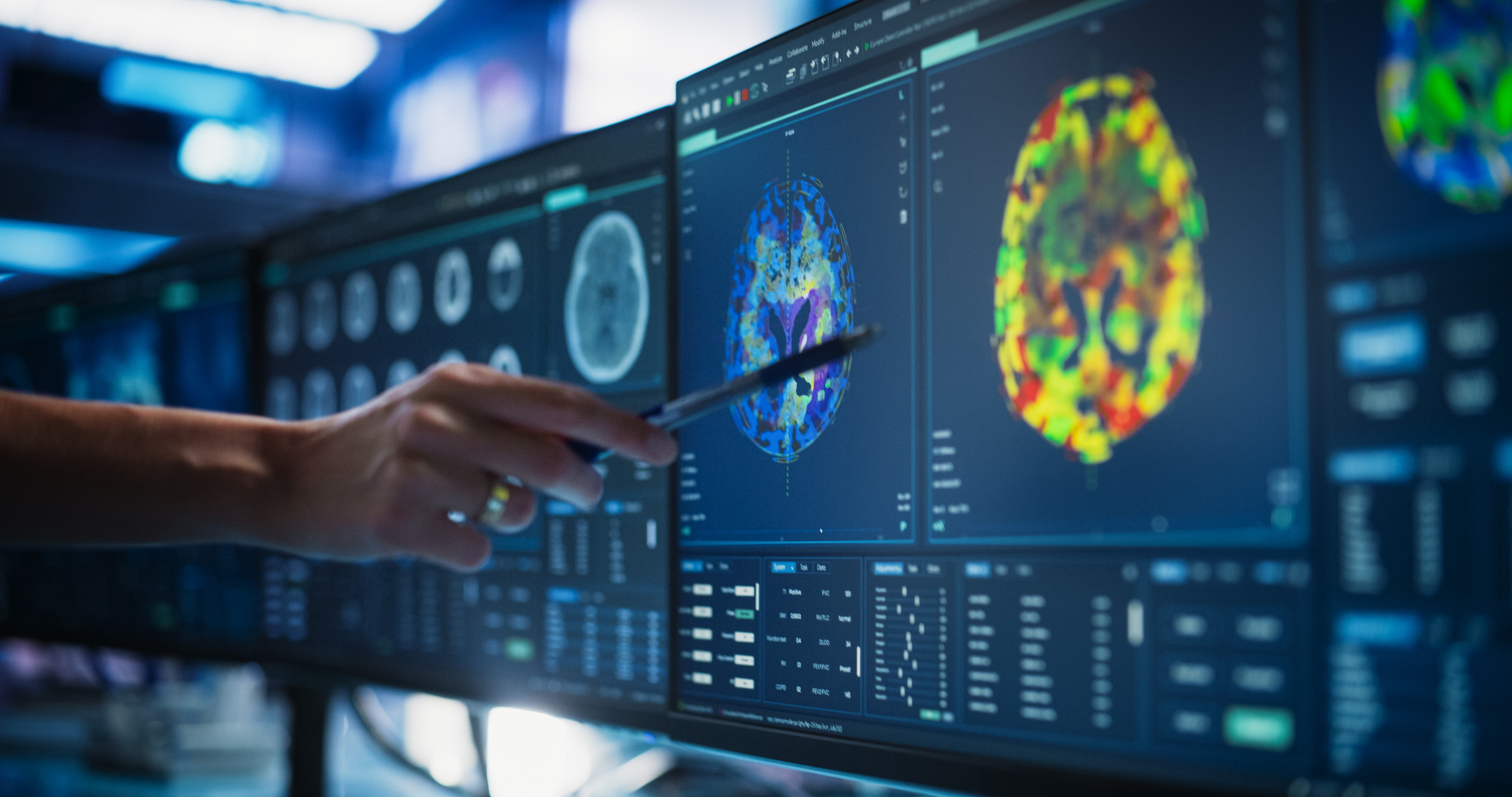 clinicians looking at image of tumor on a screen.